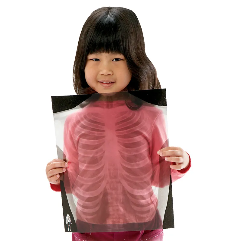 Röntgenbilder Mensch, lebensgroß  (18-tlg.)