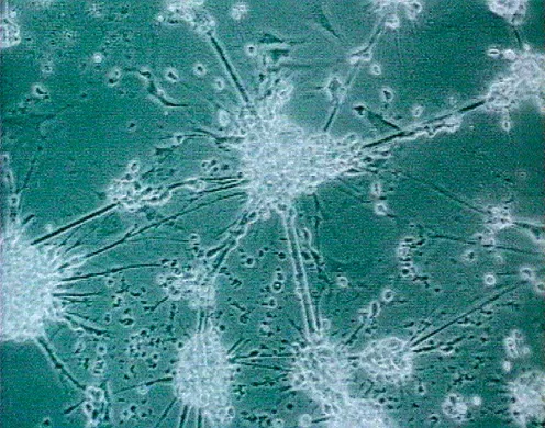 DVD-Lehrfilm Grundlagen Neurophysiologie