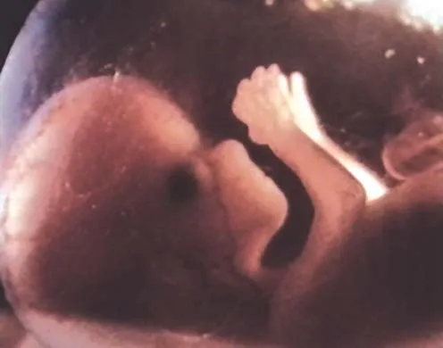 DVD-Lehrfilm Ein Leben entsteht - Zeugung, Entwicklung, Geburt