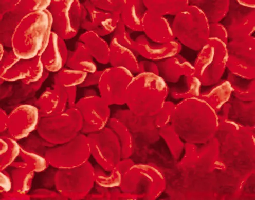 DVD-Lehrfilm Der Mensch: Der Kreislauf